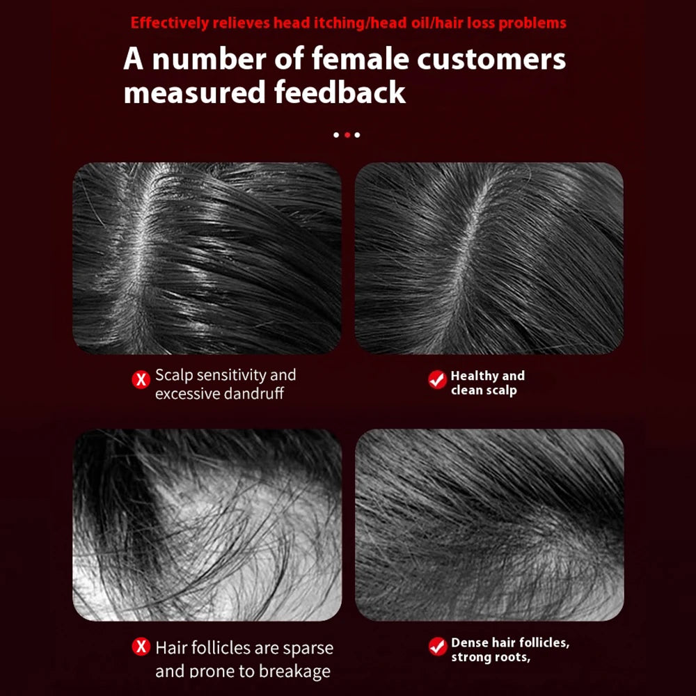 Serum-Dispensing Scalp Massage Comb